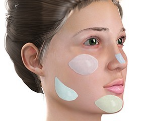 Facial Augmentation
