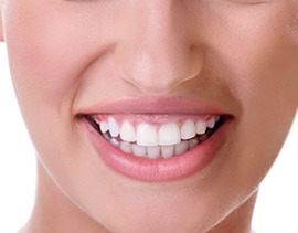 Gummy Smile Treatment