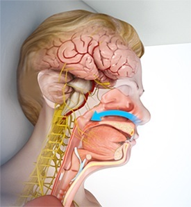 Sleep Apnea
